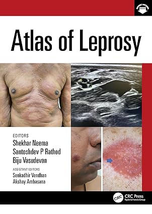 Atlas of Leprosy -Original PDF