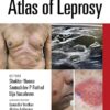 Atlas of Leprosy -EPUB