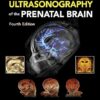 Timor’s Ultrasonography of the Prenatal Brain, Fourth Edition -Original PDF