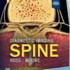 Diagnostic Imaging: Spine 5th Edition-EPUB