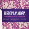 Histoplasmosis: From Diagnosis to Treatment -Original PDF
