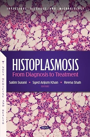 Histoplasmosis: From Diagnosis to Treatment -Original PDF