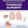 Massachusetts General Hospital Illustrated Tips and Tricks in Thoracic Surgery-EPUB