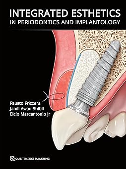 Integrated Esthetics in Periodontics and Implantology -EPUB