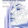 Optimizing Orthognathic Surgery: Diagnosis, Planning, Procedures -EPUB