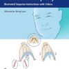 Manual of Functional and Aesthetic Rhinoplasty: Illustrated Stepwise Instructions with Videos -Original PDF+Videos