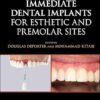 Immediate Dental Implants for Esthetic and Premolar Sites -Original PDF