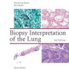 Biopsy Interpretation of the Lung(Biopsy Interpretation Series) 3rd Edition-EPUB