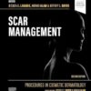 Procedures in Cosmetic Dermatology: Scar Management 2nd Edition-EPUB