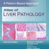 Atlas of Liver Pathology: A Pattern-Based Approach 2nd Edition-EPUB