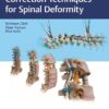 Correction Techniques for Spinal Deformity -EPUB