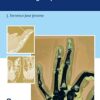 An Evidence-Based Approach to the Fingertip Diseases -EPUB