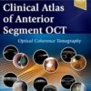 Clinical Atlas of Anterior Segment OCT: Optical Coherence Tomography -Original PDF
