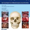 100 Complications of Otorhinolangyngology & Skull Base Surgery: Each Case Report from Different Surgeons around the Globe -EPUB