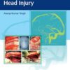 Surgical Nuances of Head Injury -EPUB