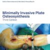 Minimally Invasive Plate Osteosynthesis (AO-Publishing) 3rd Edition-EPUB