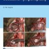 An Approach to Successful Tympanoplasty -EPUB