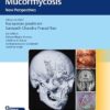 Invasive Skull Base Mucormycosis: New Perspectives -EPUB
