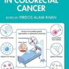 Advancements in Colorectal Cancer -EPUB