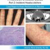Pediatric Collections: Infectious Disease Cases: Part 2: Indolent Head Scratchers: Case Reports from Pediatrics in Review -Original PDF