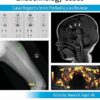 Pediatric Collections: Endocrinology Cases: Case Reports from Pediatrics in Review -Original PDF
