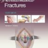 Master Techniques in Orthopaedic Surgery: Fractures 4th edition-EPUB