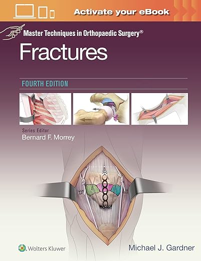 Master Techniques in Orthopaedic Surgery: Fractures 4th edition-EPUB