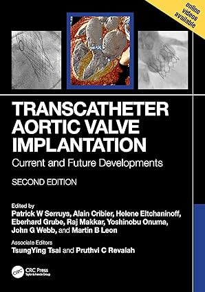 Transcatheter Aortic Valve Implantation: Current and Future Developments 2nd Edition-Original PDF
