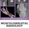 Musculoskeletal Radiology: An Ultimate Guide to Passing the Final FRCR (FRCRverse) -EPUB