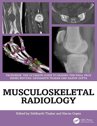 Musculoskeletal Radiology: An Ultimate Guide to Passing the Final FRCR (FRCRverse) -EPUB