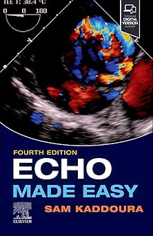 Echo Made Easy 4th Edition-EPUB