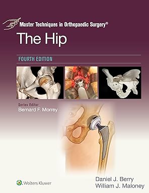 Master Techniques in Orthopaedic Surgery: The Hip 4th Edition-EPUB