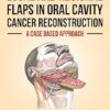 Local and Regional Flaps in Oral Cavity Cancer Reconstruction: A case-based approach -EPUB