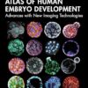 Atlas of Human Embryo Development: Advances with New Imaging Technologies -EPUB