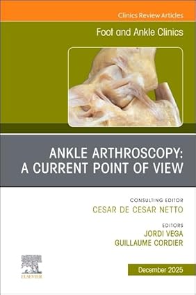 Ankle Arthroscopy: A Current Point of View, An issue of Foot and Ankle Clinics of North America (Volume 30-4) (The Clinics: Orthopedics, Volume 30-4) -EPUB