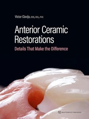 Anterior Ceramic Restorations: Details That Make the Difference -EPUB