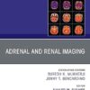 Adrenal and Renal Imaging, An Issue of Magnetic Resonance Imaging Clinics of North America(The Clinics: Radiology) -EPUB