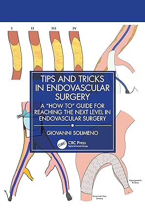 Tips and Tricks in Endovascular Surgery: A "How to" Guide for reaching the next Level in Endovascular Surgery -Original PDF