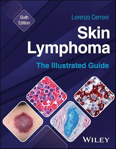 Skin Lymphoma: The Illustrated Guide 6th Edition-Original PDF