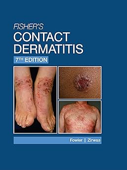 Fisher's Contact Dermatitis - 7th Edition -EPUB