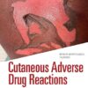 Cutaneous Adverse Drug Reactions: A Case Based Approach for Deeply Pigmented Skin (Series in Dermatological Treatment) -EPUB