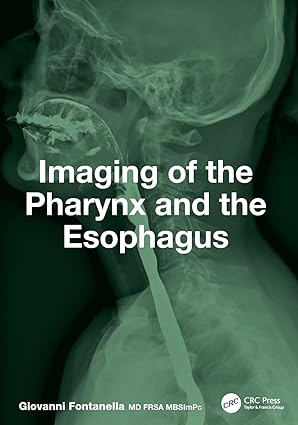 Imaging of the Pharynx and the Esophagus -EPUB