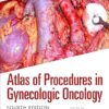 Atlas of Procedures in Gynecologic Oncology 4th edition -Original PDF