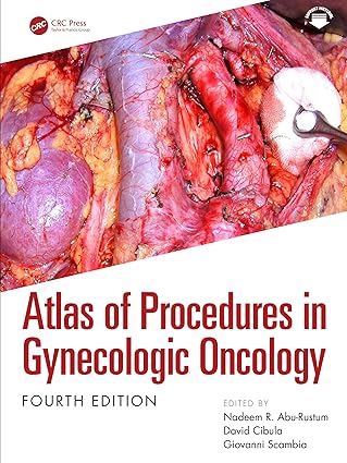 Atlas of Procedures in Gynecologic Oncology 4th edition-EPUB