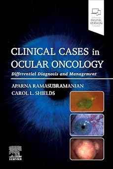Clinical Cases in Ocular Oncology: Differential Diagnosis and Management -EPUB