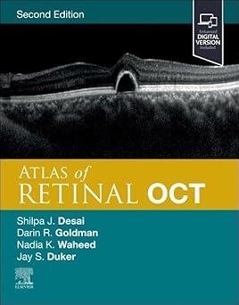 Atlas of Retinal OCT: Optical Coherence Tomography 2nd Edition-Original PDF