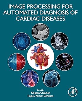 Image Processing for Automated Diagnosis of Cardiac Diseases -True PDF