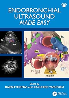 Endobronchial Ultrasound Made Easy -Original PDF