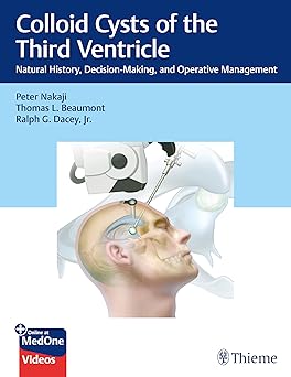 Colloid Cysts of the Third Ventricle: Natural History, Decision-Making, and Operative Management -EPUB