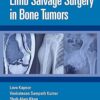 Limb Salvage Surgery in Bone Tumors 1st Edition-Original PDF